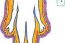 Basal Metabolic Rate (BMR)